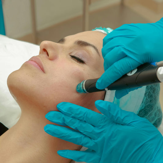 MICRODERMABRASION